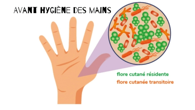 Visuel avant hygiène